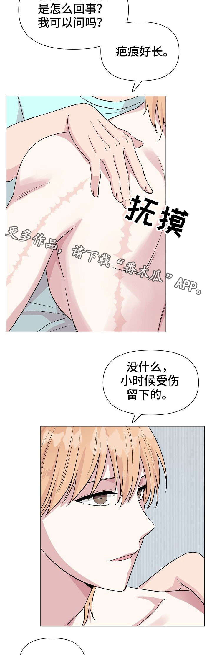 第18章：疤痕11