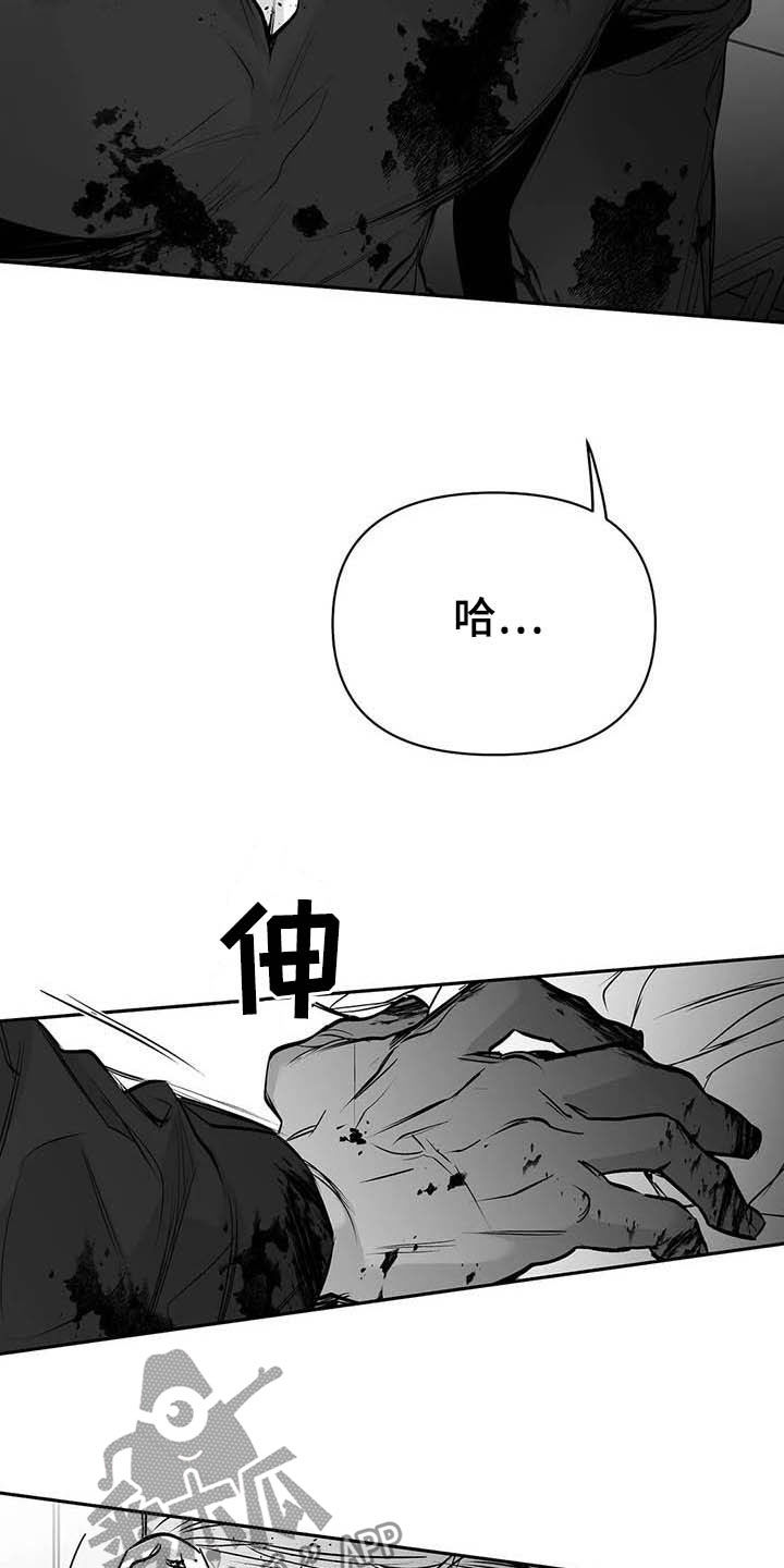 第145章：【第三季】手术13