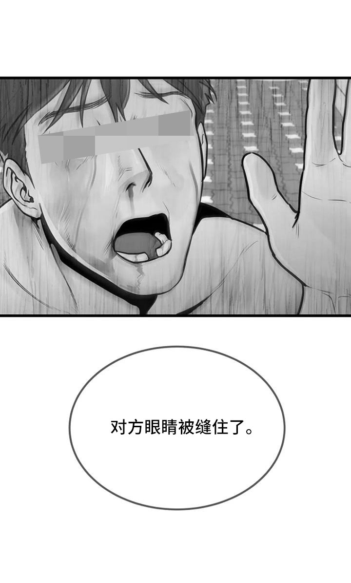 第44章：眼睛缝住了32
