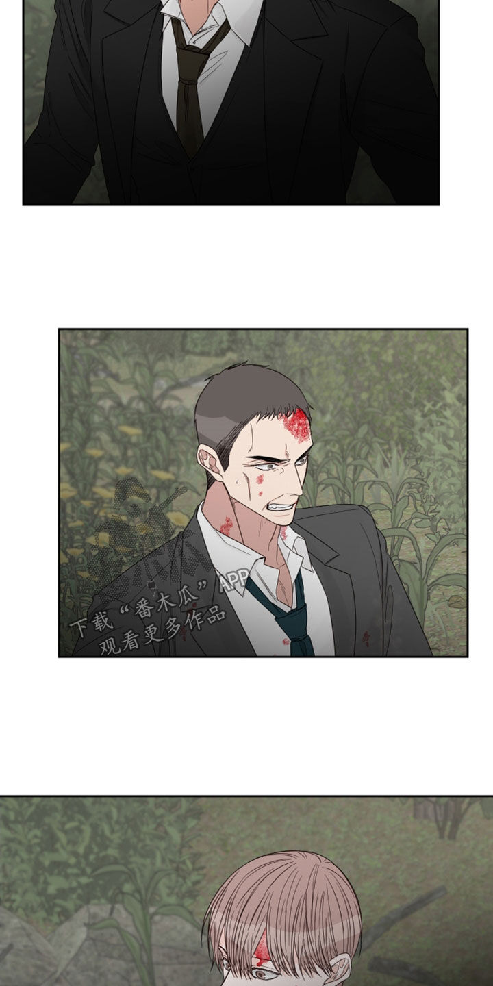 第75章：【第二季】受伤1