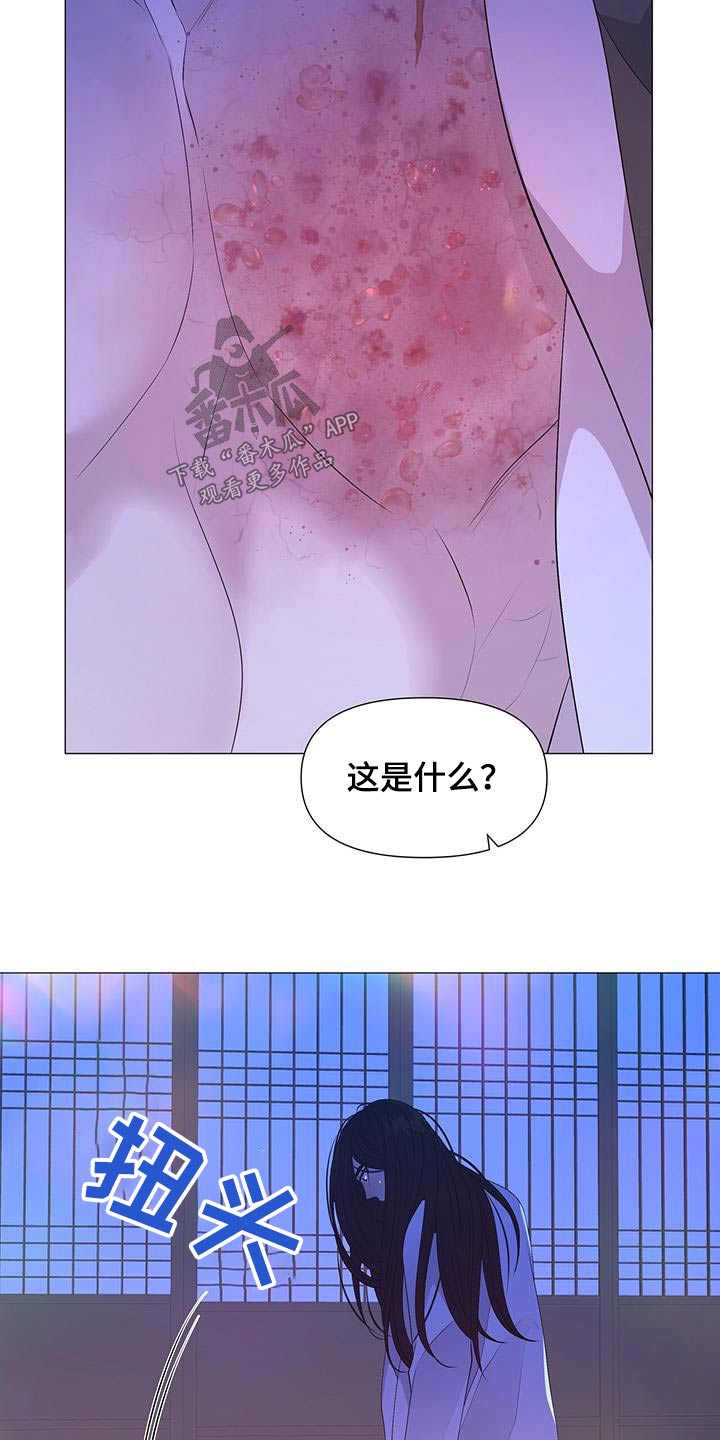 第112章：伤口25
