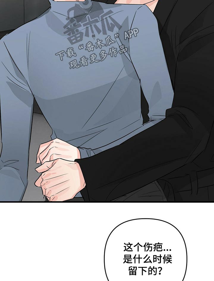第67章：疤痕15