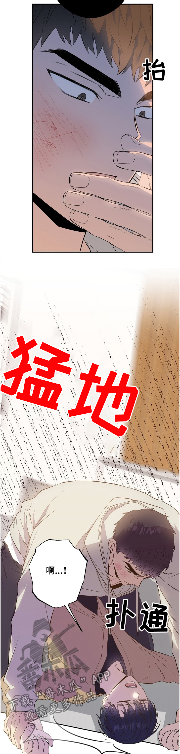 第63章：受伤4