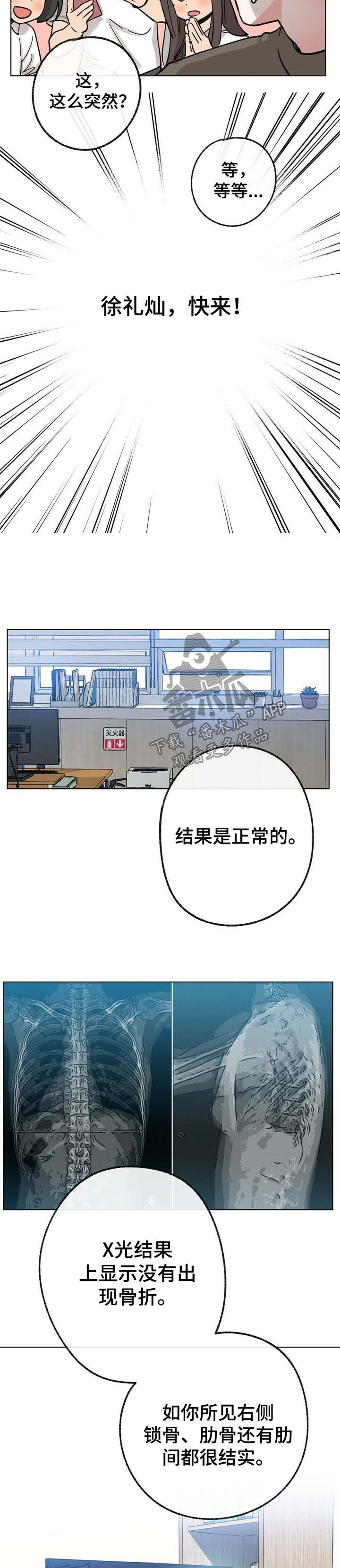 第38章：心律不齐4