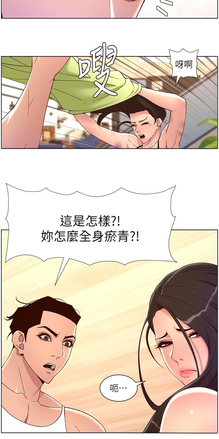 第52章：淤青6