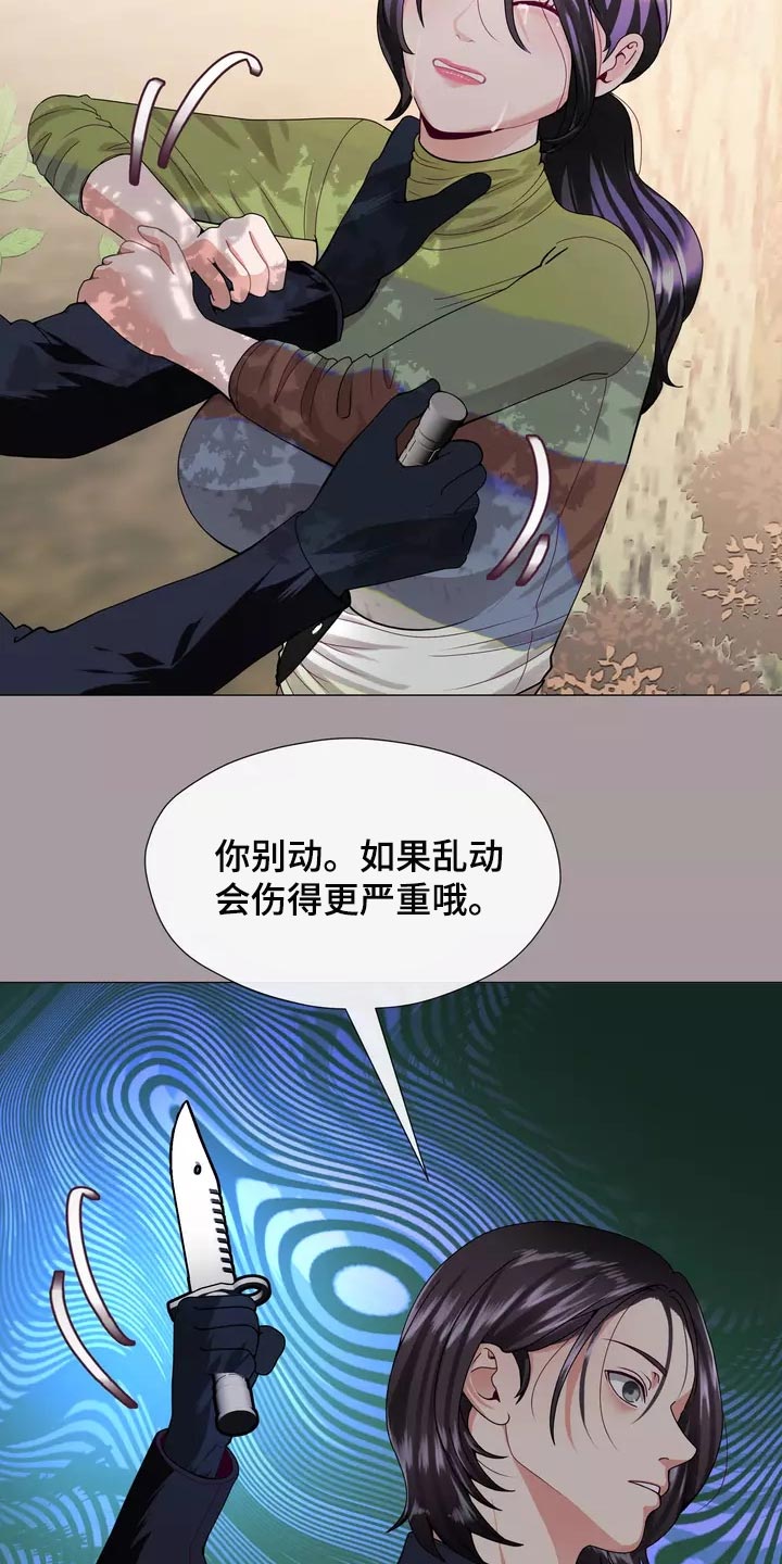第36章：疤痕11