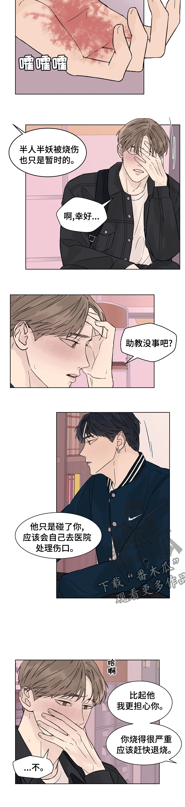 第76章：烧伤1