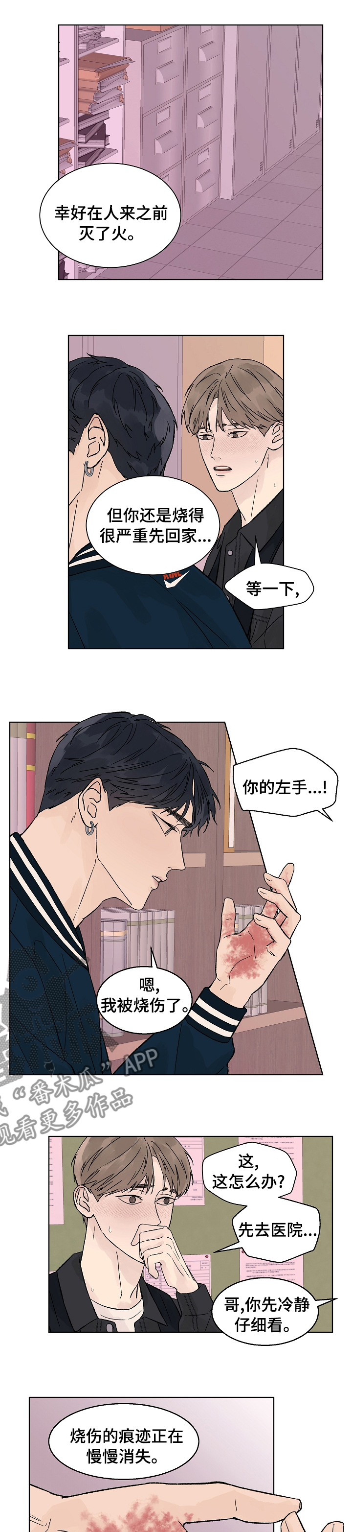 第76章：烧伤0