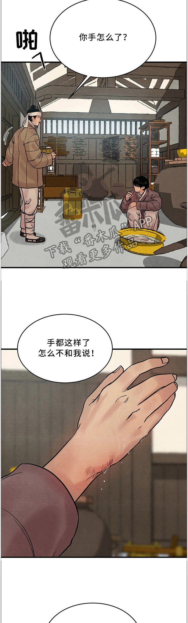 第103章：【第二季】受伤4